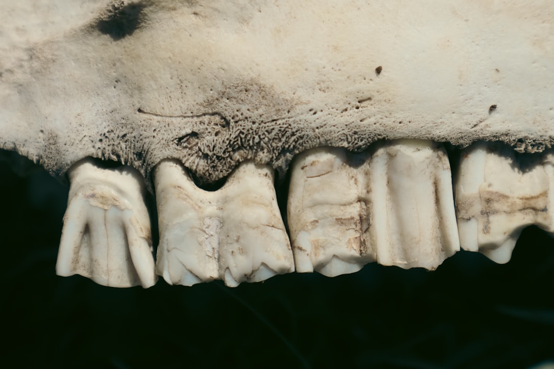 découvrez tout ce qu’il faut savoir sur les dentures : types, avantages, entretien et conseils pour choisir la prothèse dentaire adaptée à vos besoins. retrouvez le confort d’un sourire naturel !